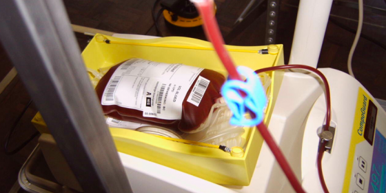 Oddaj krew w Wiśle. To tak niewiele, a może uratować życie!
